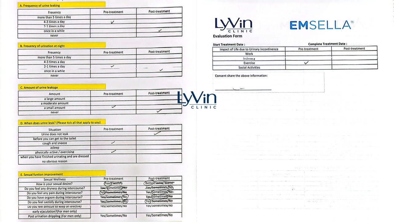 Non-invasive Emsella chair treatment results Non-invasive Emsella chair treatment results