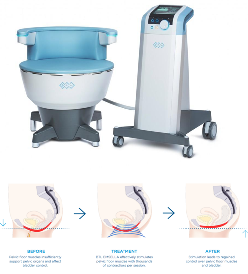 EMSELLA treatment for urinary incontinence in Johor Bahru